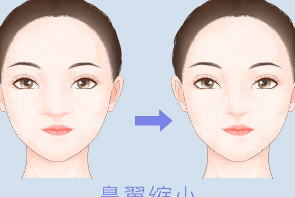 这些整形知识一定要了解_https://www.ashangmei.com_整形知识_第2张