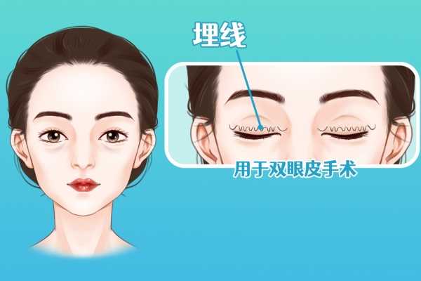 太原市眼睑内外翻医院上榜清单前十提前预告-太原市眼睑内外翻整形医院_整形百科